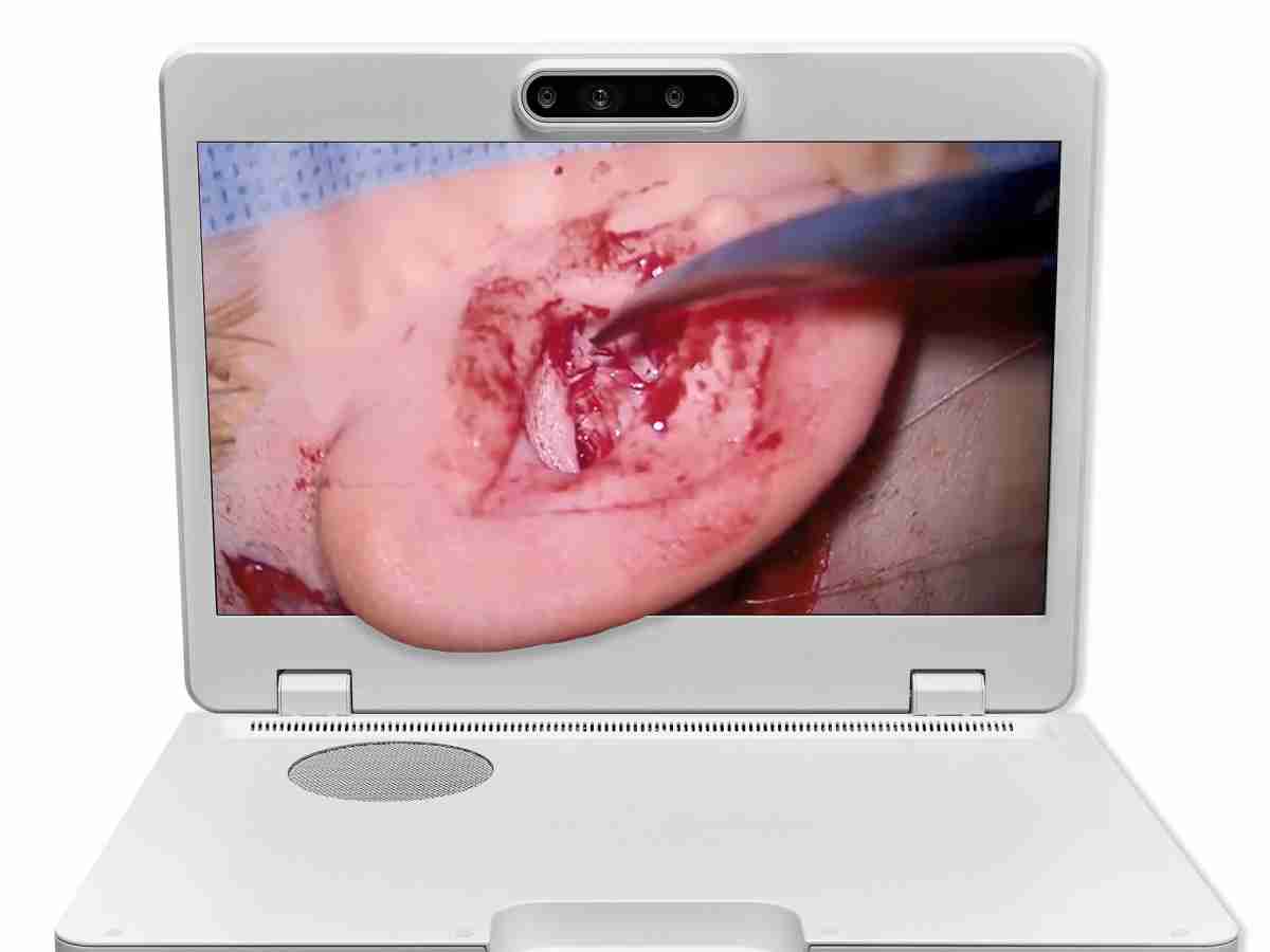 达擎之＂Heads-up 3D显微手术显示系统＂，，整合4K裸眼3D显示及眼球追踪系统，，，，具备快速追踪人眼移动位置功能，，，，减轻医师长时间维持固定姿势的负担，，，，让医师能有更宽广清晰的3D立体视野及更舒适的姿势来执行手术。。